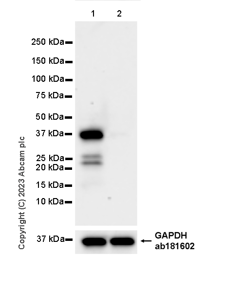 Western blot - Anti-Calponin 3 antibody [EPR28430-76] - BSA and Azide free (ab314330), expandable thumbnail