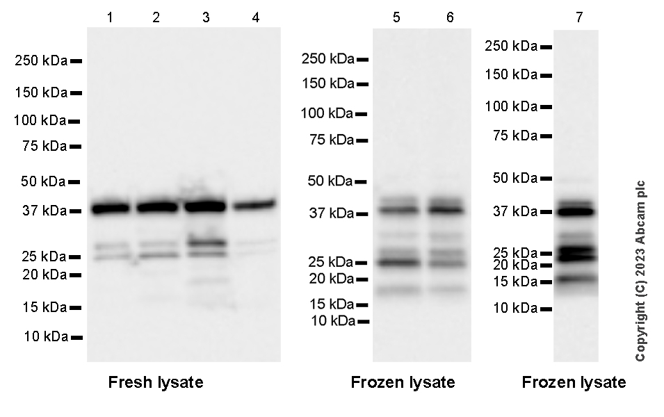 Western blot - Anti-Calponin 3 antibody [EPR28430-76] - BSA and Azide free (ab314330), expandable thumbnail