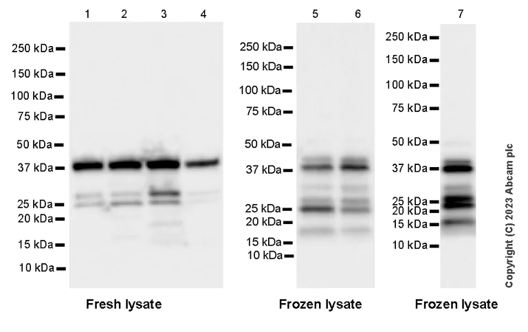 Western blot - Anti-Calponin 3 antibody [EPR28430-76] - BSA and Azide free (AB314330)