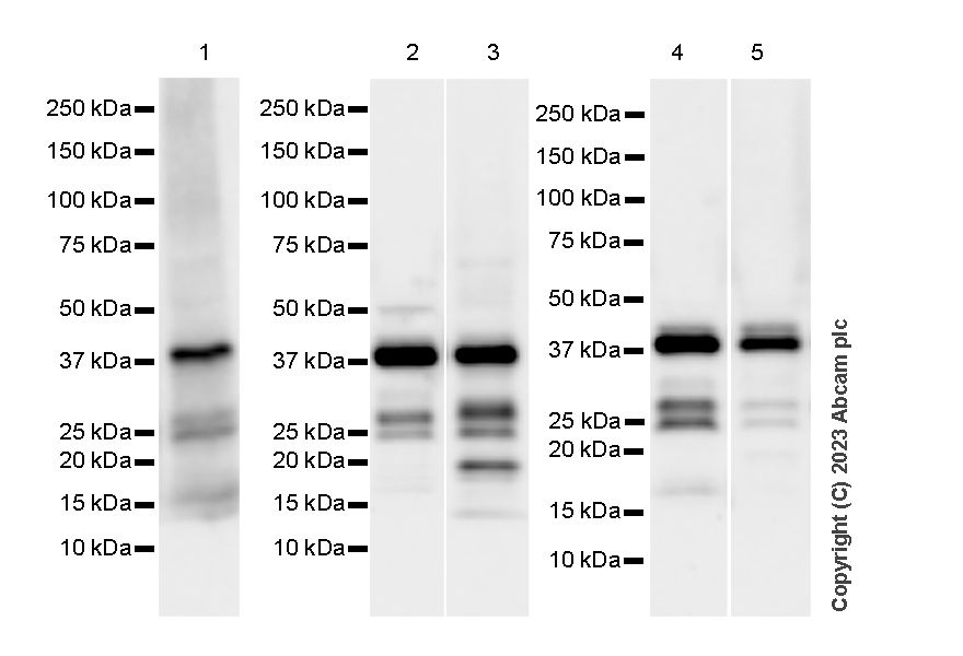 Western blot - Anti-Calponin 3 antibody [EPR28430-76] - BSA and Azide free (ab314330), expandable thumbnail
