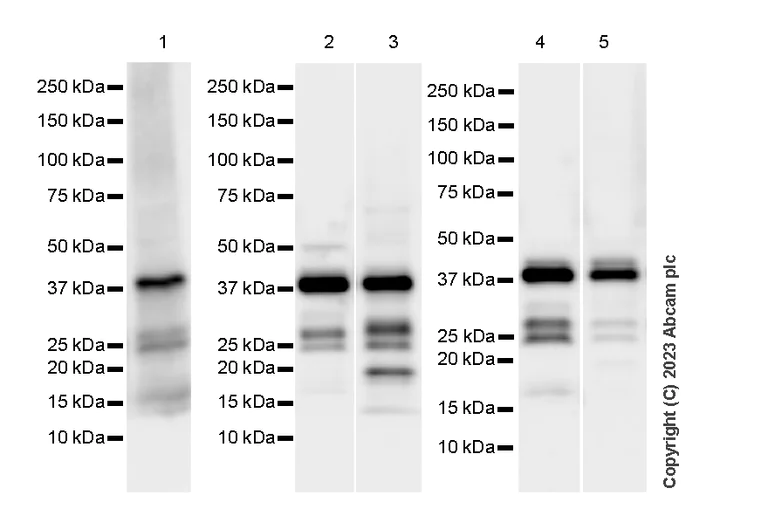 Western blot - Anti-Calponin 3 antibody [EPR28430-76] - BSA and Azide free (AB314330)