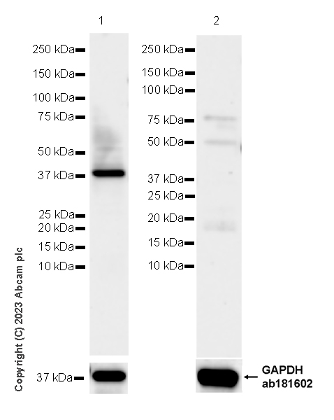 Western blot - Anti-Calponin 3 antibody [EPR28430-76] - BSA and Azide free (ab314330), expandable thumbnail