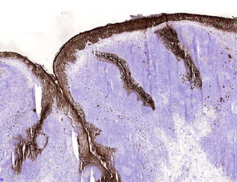 Immunohistochemistry (Frozen sections) - Anti-Calprotectin (S100A8 + S100A9) antibody [27E10] (AB17050)