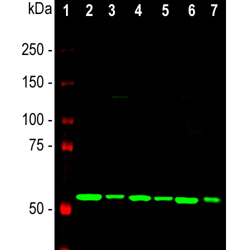 Western blot - Anti-Calreticulin antibody [6C6] (AB315210)
