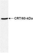 Western blot - Anti-Calreticulin antibody (AB15607)