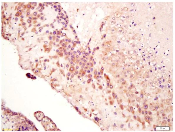 Immunohistochemistry (Formalin/PFA-fixed paraffin-embedded sections) - Anti-Calreticulin antibody (AB217874)