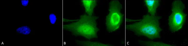 Immunocytochemistry/ Immunofluorescence - Anti-Calreticulin antibody (AB223614)
