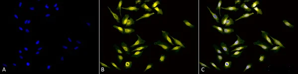 Immunocytochemistry/ Immunofluorescence - Anti-Calreticulin antibody (AB223614)