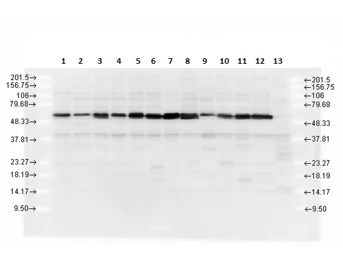 Western blot - Anti-Calreticulin antibody (AB223614)