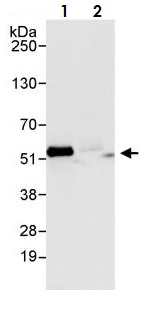 Immunoprecipitation - Anti-Calreticulin antibody (AB265598), expandable thumbnail