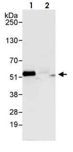 Immunoprecipitation - Anti-Calreticulin antibody (AB265598)