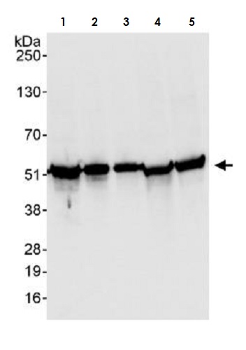 Western blot - Anti-Calreticulin antibody (AB265598), expandable thumbnail