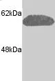 Western blot - Anti-Calreticulin antibody (AB2908)