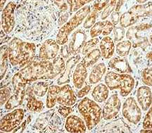 Immunohistochemistry (Formalin/PFA-fixed paraffin-embedded sections) - Anti-Calreticulin antibody [EPR3924] - BSA and Azide free (AB271865)