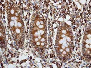 Immunohistochemistry (Formalin/PFA-fixed paraffin-embedded sections) - Anti-Calreticulin antibody [EPR3924] - BSA and Azide free (ab271865), expandable thumbnail