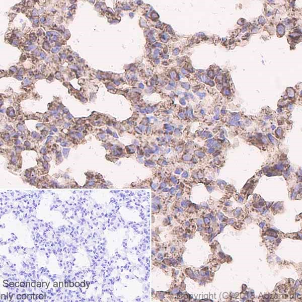 Immunohistochemistry (Formalin/PFA-fixed paraffin-embedded sections) - Anti-Calreticulin antibody [EPR3924] - BSA and Azide free (AB271865), expandable thumbnail