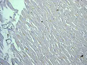 Immunohistochemistry (Formalin/PFA-fixed paraffin-embedded sections) - Anti-Calreticulin antibody [EPR3924] - ER Marker (AB92516)