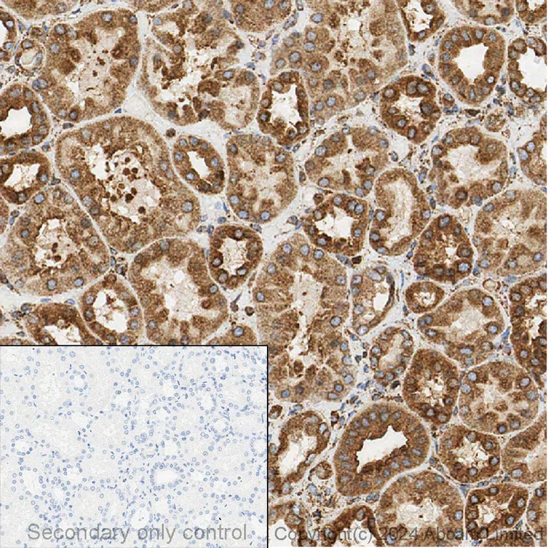 Immunohistochemistry - Anti-Calreticulin antibody [EPR3924] - ER Marker (AB92516)