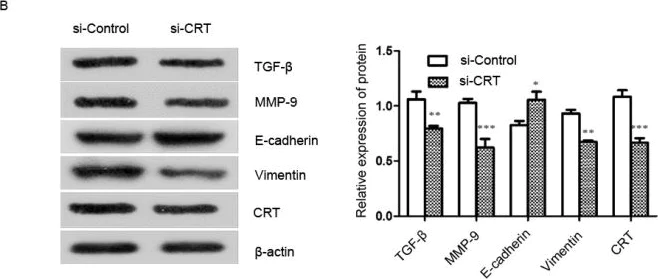 Western blot - Anti-Calreticulin antibody [EPR3924] - ER Marker (AB92516)