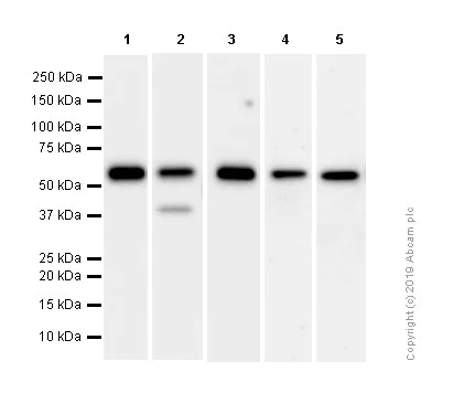 Western blot - Anti-Calreticulin antibody [EPR3924] - ER Marker (AB92516)