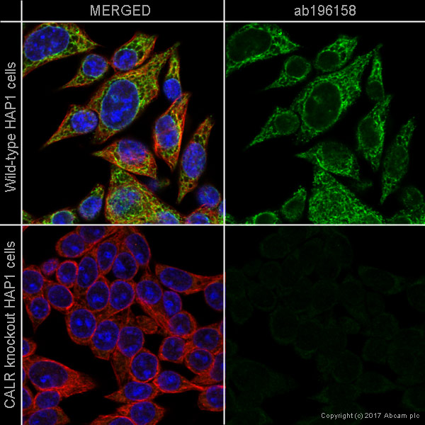 Immunocytochemistry/ Immunofluorescence - Anti-Calreticulin antibody [EPR3924] - Low endotoxin, Azide free (AB211962)
