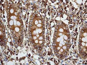 Immunohistochemistry (Formalin/PFA-fixed paraffin-embedded sections) - Anti-Calreticulin antibody [EPR3924] - Low endotoxin, Azide free (AB211962)