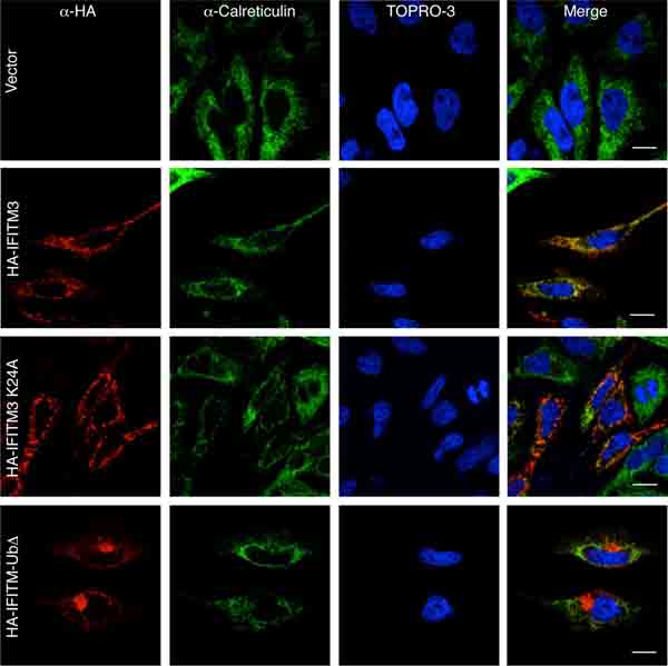 Immunocytochemistry/ Immunofluorescence - Anti-Calreticulin antibody - ER Marker (AB2907), expandable thumbnail
