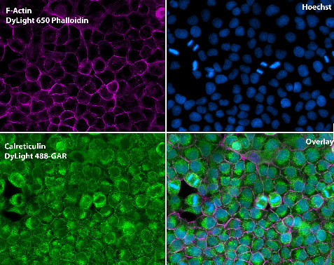 Anti-calreticulin antibody - ER marker (ab2907) | Abcam