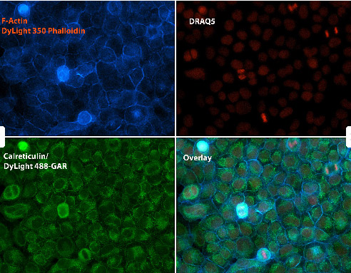 Immunocytochemistry/ Immunofluorescence - Anti-Calreticulin antibody - ER Marker (ab2907), expandable thumbnail