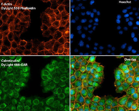 Immunocytochemistry/ Immunofluorescence - Anti-Calreticulin antibody - ER Marker (ab2907), expandable thumbnail