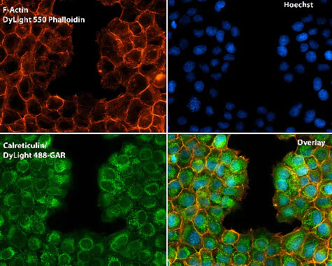Immunocytochemistry/ Immunofluorescence - Anti-Calreticulin antibody - ER Marker (AB2907)