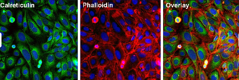 Immunocytochemistry/ Immunofluorescence - Anti-Calreticulin antibody - ER Marker (ab2907), expandable thumbnail