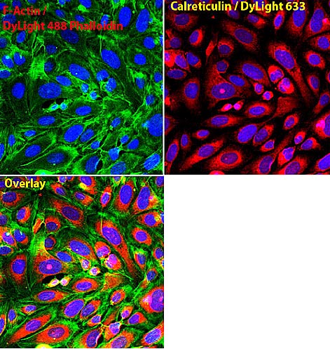 Immunocytochemistry/ Immunofluorescence - Anti-Calreticulin antibody - ER Marker (AB2907), expandable thumbnail
