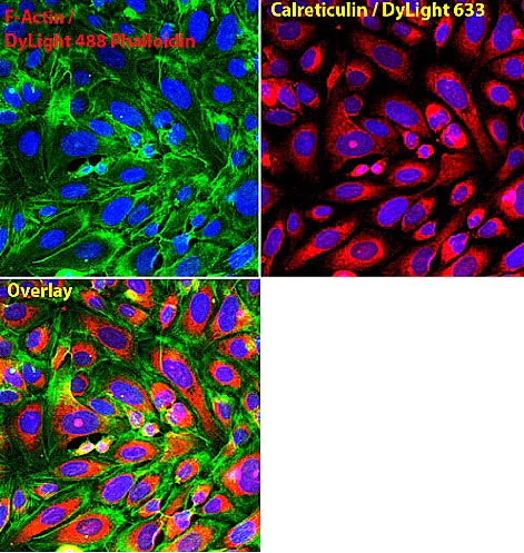 Immunocytochemistry/ Immunofluorescence - Anti-Calreticulin antibody - ER Marker (AB2907)