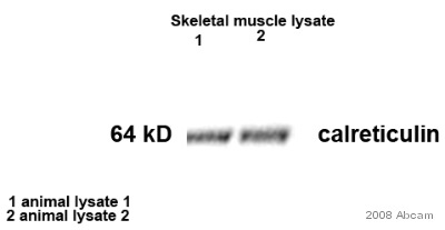 Western blot - Anti-Calreticulin antibody - ER Marker (AB2907), expandable thumbnail