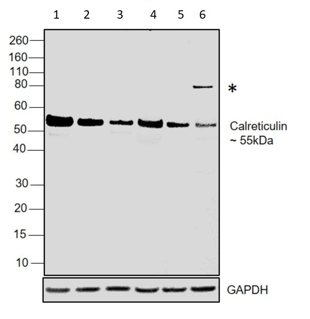 Western blot - Anti-Calreticulin antibody - ER Marker (AB2907), expandable thumbnail