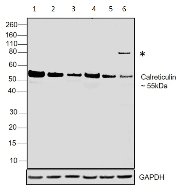 Western blot - Anti-Calreticulin antibody - ER Marker (AB2907)