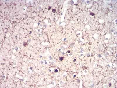 Immunohistochemistry (Formalin/PFA-fixed paraffin-embedded sections) - Anti-Calretinin antibody [1F5H1] (AB204990), expandable thumbnail