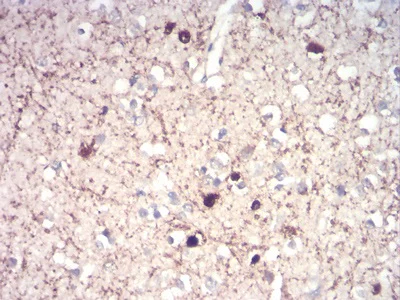 Immunohistochemistry (Formalin/PFA-fixed paraffin-embedded sections) - Anti-Calretinin antibody [1F5H1] (AB204990)