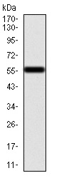 Western blot - Anti-Calretinin antibody [1F5H1] (AB204990), expandable thumbnail