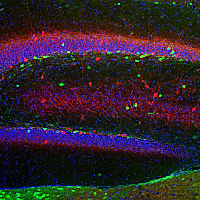 Immunohistochemistry - Anti-Calretinin antibody [6A9] (AB277631)