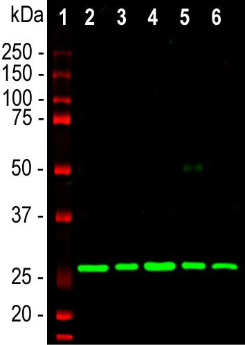Western blot - Anti-Calretinin antibody [6A9] (AB277631)