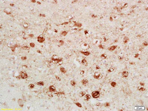 Immunohistochemistry (Formalin/PFA-fixed paraffin-embedded sections) - Anti-Calretinin antibody (AB203055)