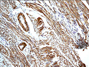 Immunohistochemistry (Formalin/PFA-fixed paraffin-embedded sections) - Anti-Calretinin antibody (AB203055)