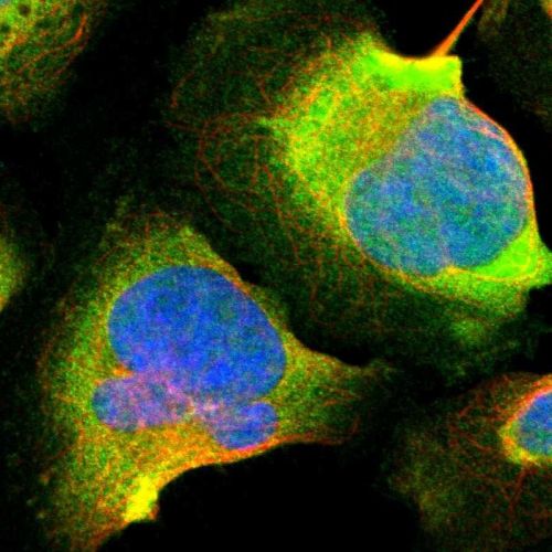 Immunocytochemistry/ Immunofluorescence - Anti-Calretinin antibody (AB244299), expandable thumbnail