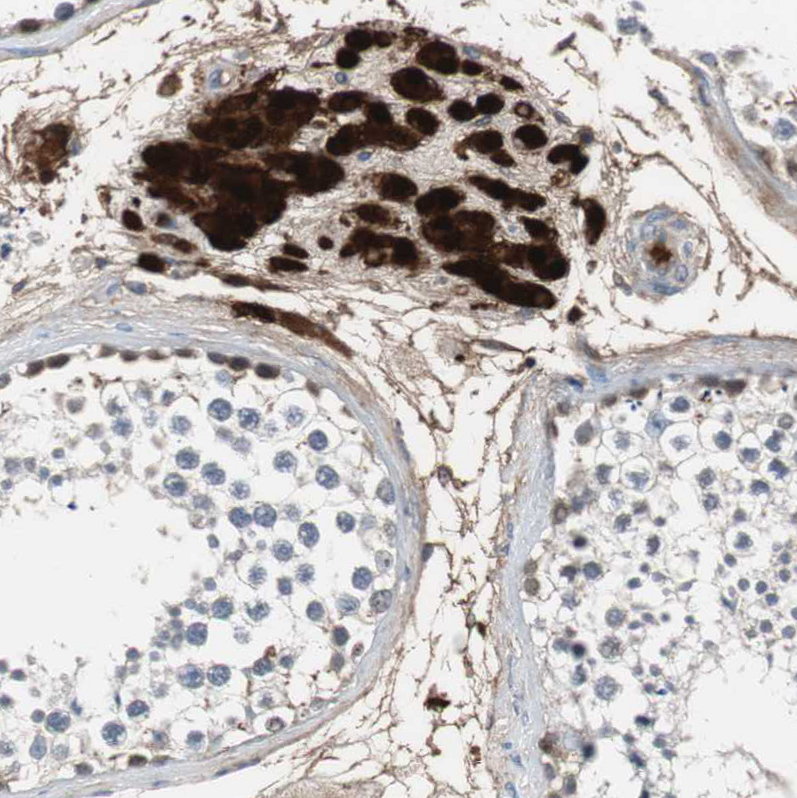 Immunohistochemistry (Formalin/PFA-fixed paraffin-embedded sections) - Anti-Calretinin antibody (AB244299), expandable thumbnail
