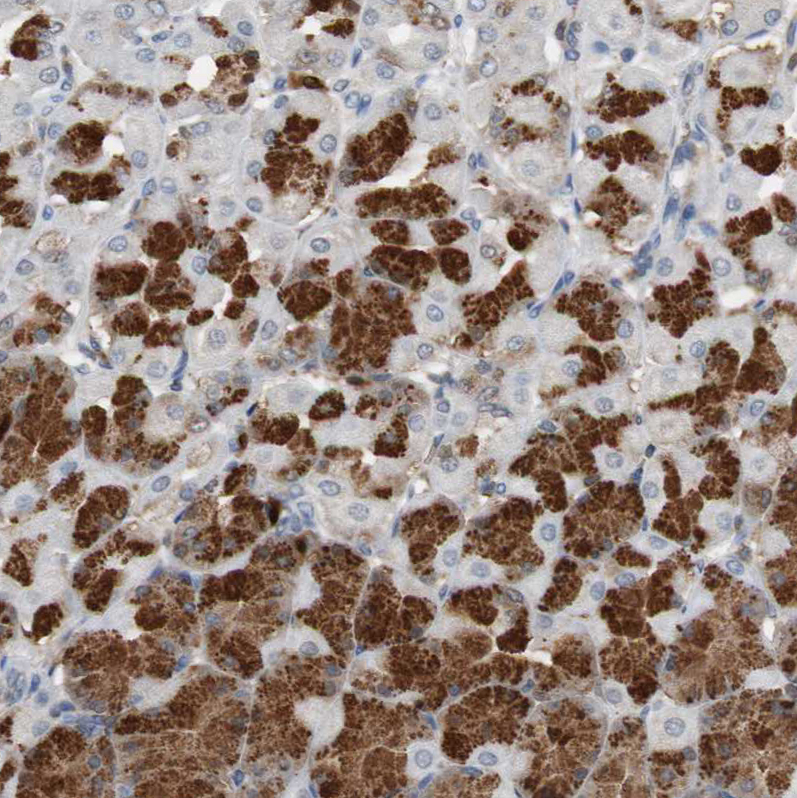 Immunohistochemistry (Formalin/PFA-fixed paraffin-embedded sections) - Anti-Calretinin antibody (AB244299), expandable thumbnail