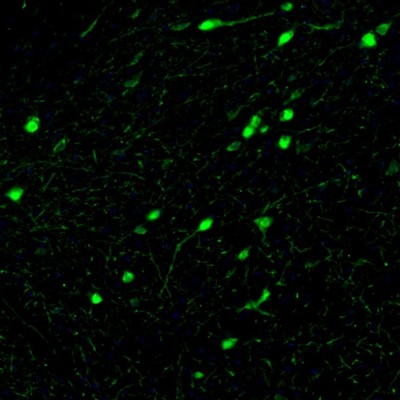 Immunohistochemistry (Formalin/PFA-fixed paraffin-embedded sections) - Anti-Calretinin antibody (ab244299), expandable thumbnail