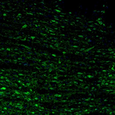 Immunohistochemistry (Formalin/PFA-fixed paraffin-embedded sections) - Anti-Calretinin antibody (ab244299), expandable thumbnail