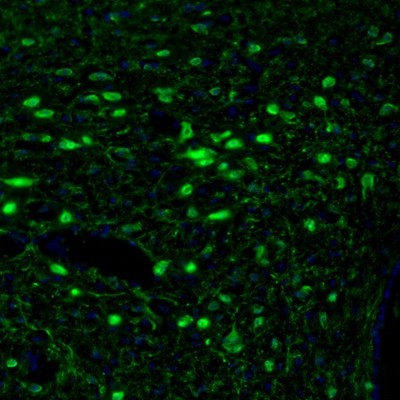 Immunohistochemistry (Formalin/PFA-fixed paraffin-embedded sections) - Anti-Calretinin antibody (ab244299), expandable thumbnail